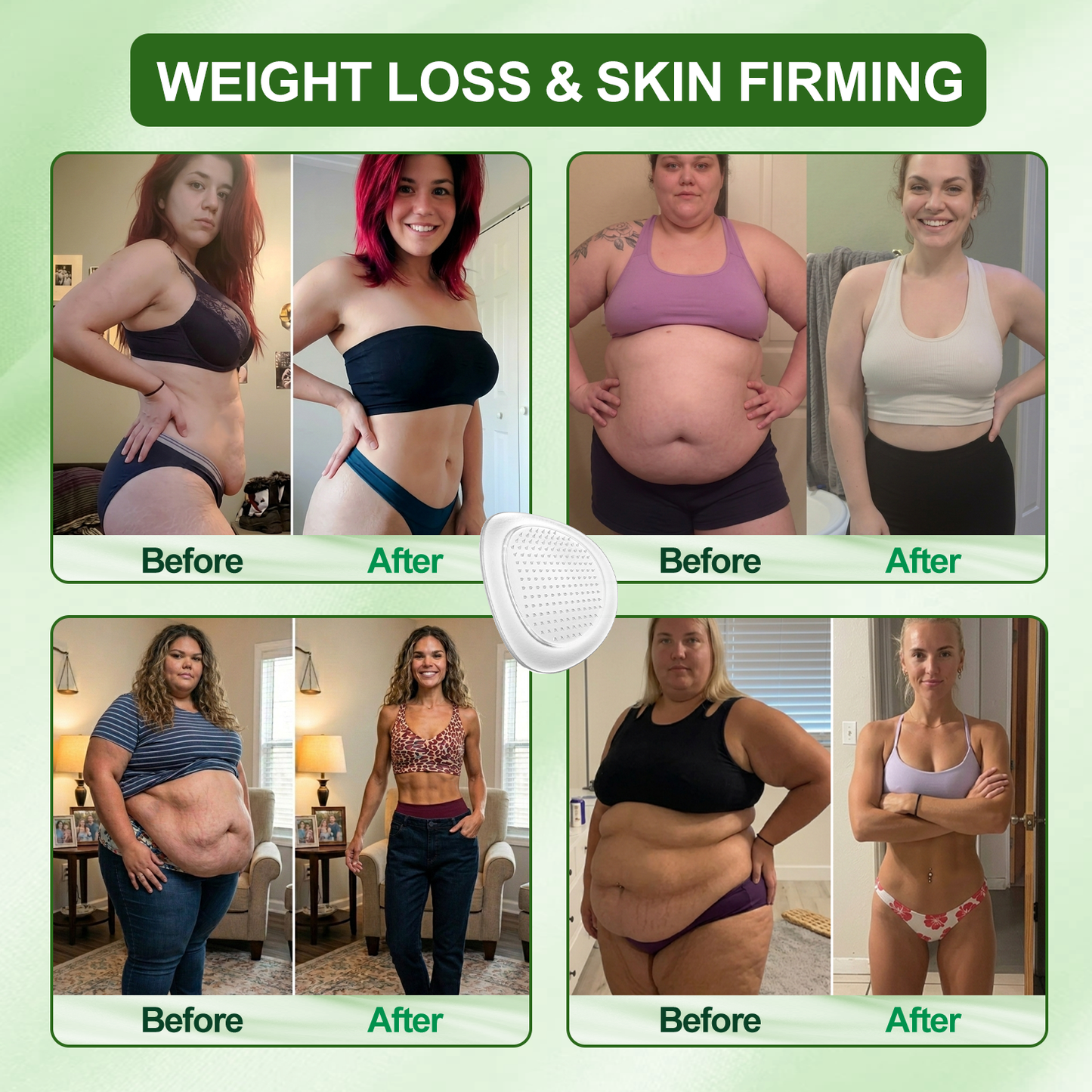 O[𝟐𝟎𝟐𝟔 𝐍𝐞𝐰 & 𝐔𝐩𝐠𝐫𝐚𝐝𝐞𝐝: 𝟖𝟎% 𝐎𝐅𝐅] ✅ 𝐃𝐑.𝐇𝐎𝐍𝐎𝐑® 𝐋𝐲𝐦𝐩𝐡𝐚𝐭𝐢𝐜 𝐃𝐫𝐚𝐢𝐧𝐚𝐠𝐞 𝐒𝐥𝐢𝐦𝐦𝐢𝐧𝐠 𝐍𝐚𝐧𝐨-𝐌𝐢𝐜𝐫𝐨𝐧𝐞𝐞𝐝𝐥𝐞 𝐏𝐚𝐭𝐜𝐡: 𝐔𝐥𝐭𝐫𝐚-𝐏𝐨𝐭𝐞𝐧𝐭 𝟓× 𝐅𝐨𝐫𝐦𝐮𝐥𝐚 𝐰𝐢𝐭𝐡 𝐋𝐢𝐩𝐨𝐥𝐲𝐭𝐢𝐜 𝐏𝐞𝐩𝐭𝐢𝐝𝐞 𝐂𝐨𝐦𝐩𝐥𝐞𝐱 — 𝐒𝐮𝐩𝐩𝐨𝐫𝐭𝐬 𝐖𝐞𝐢𝐠𝐡𝐭 𝐋𝐨𝐬𝐬 & 𝐋𝐲𝐦𝐩𝐡𝐚𝐭𝐢𝐜 𝐅𝐥𝐨𝐰 — 𝐏𝐥𝐮𝐬 𝐉𝐨𝐢𝐧𝐭 𝐑𝐞𝐥𝐢𝐞𝐟, 𝐁𝐞𝐭𝐭𝐞𝐫 𝐒𝐥𝐞𝐞𝐩 & 𝐌𝐞𝐧𝐭𝐚𝐥 𝐂𝐥𝐚𝐫𝐢𝐭𝐲.